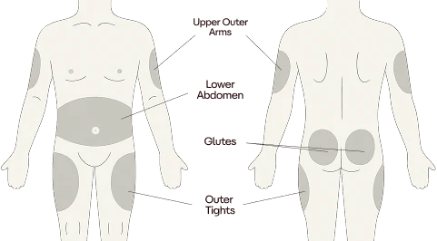 Injection site diagram
